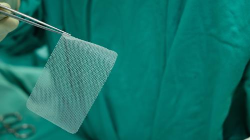 A surgeon preparing hernia mesh for an operation.