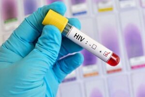 positive HIV test, Truvada lawsuit concept image