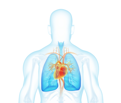 IVC filter lawsuit join, inferior vena cava filter lawsuit, contact an inferior vena cava IVC filter lawsuit attorney, IVC filter lawsuit.