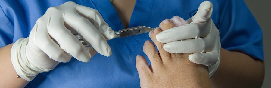 A woman will need to file a Cartiva implant lawsuit after finding out her toe is infected.